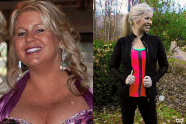 Before & After Keto Weight Loss